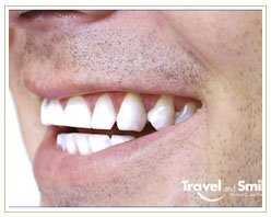 Slider image (5) Travel and Smile